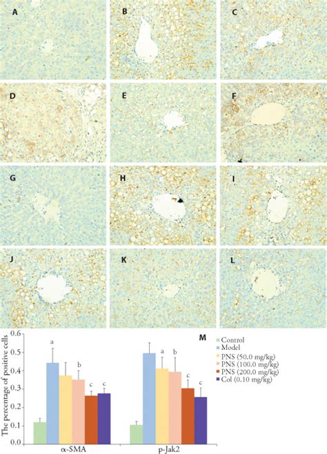 Effect Of Pns On Sma And P Jak In Liver Of Hepatic Fibrosis Rats