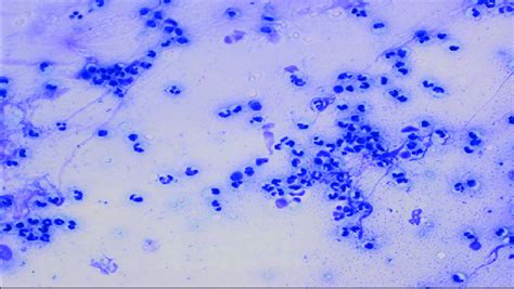 Cytological Smear Obtained By Cytobrush Method From Subclinical Download Scientific Diagram