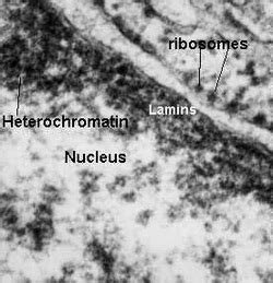 Nucleus & Nucleolus - Cell Body