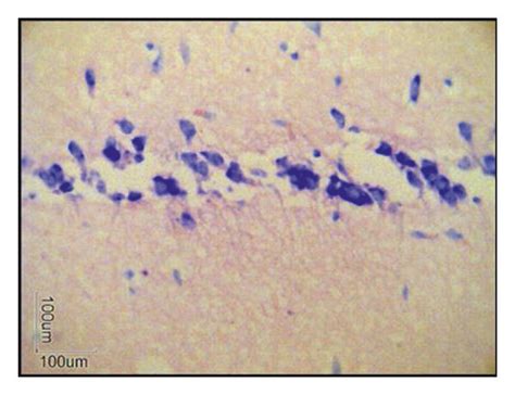 Histological analysis of the CA1 region in hippocampus brain tissue ... 