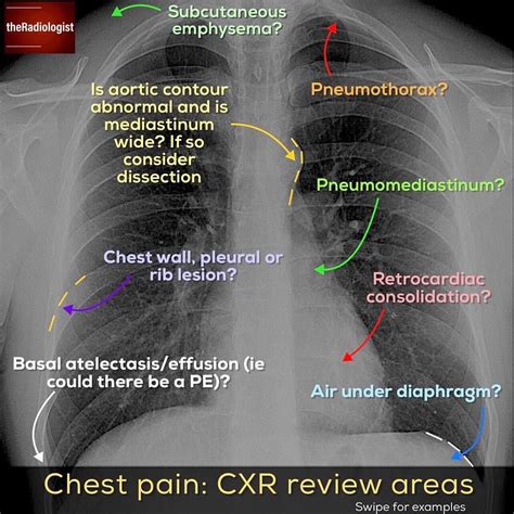 Pin Auf Radiology Anatomy