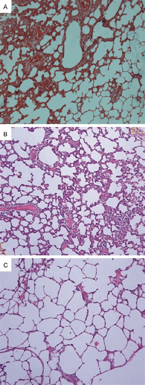 Figure From Effects Of All Trans Retinoic Acid On Expressions Of