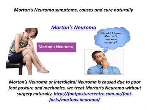 PPT - Morton’s Neuroma symptoms, causes and cure naturally PowerPoint ...