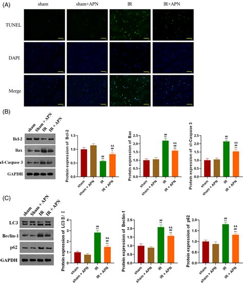 Apn Protects Skeletal Muscle From Ir Injury By Inhibiting Apoptosis And