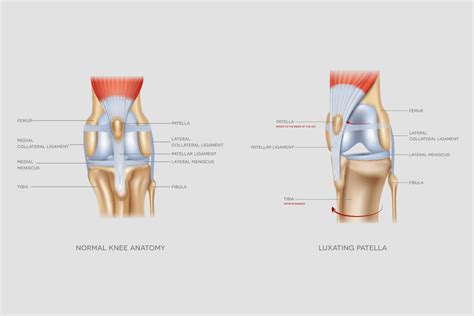 Luxating Patella in Dogs · Falls Village Vet Hospital