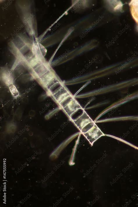 Chaetoceros (Diatom) under microscope view. Stock Photo | Adobe Stock