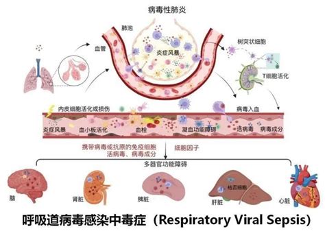 曹彬教授呼吸道病毒性感染中毒症的表现潜在机制与细菌性脓毒症的治疗有何异同 腾讯新闻