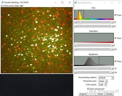 Imagej实用技巧——荧光共标细胞计数解放双手篇 知乎