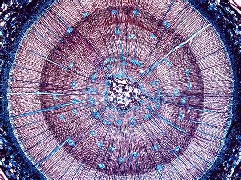 Cross section of Pinus stem (pine tree) | Nikon Small World