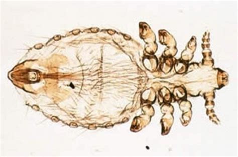 lice Flashcards | Quizlet