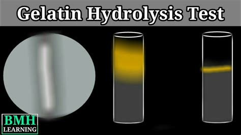 Geletin Hydrolysis Test Biochemical Test For Gelatinase Youtube