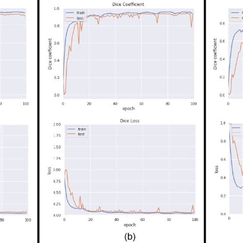 Dice Coefficient and Dice Loss Training curves of the RV segmentation ...