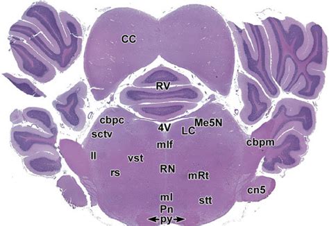 Level Caudal Colliculi Cerebellum And Brainstem Cbpc Indicates