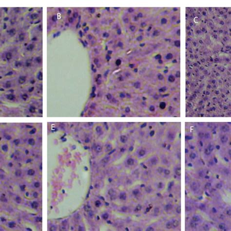 A A Photomicrograph Of The Liver Showing Normal Morphological