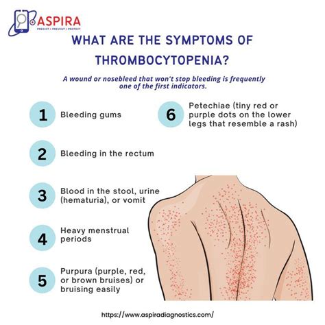 Symptoms of Thrombocytopenia. in 2022 | Bleeding gum, Pathology lab ...