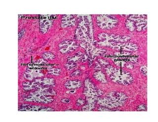 Male Reproductive system histology | PPT