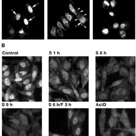 The Cytoplasmic Localization Of HuR Is Regulated By Amino Acid