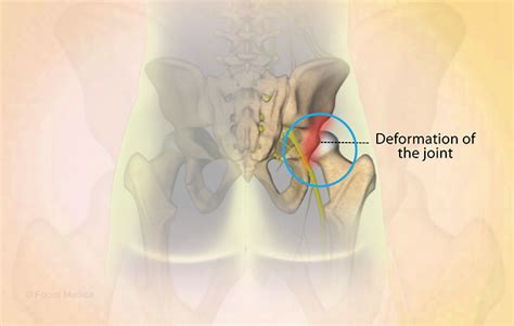 Health Condition : Symptoms, Causes, Treatment and More