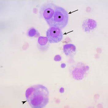 (PDF) Chylous effusion in a dog related to malignant peritoneal mesothelioma: cytological diagnosis