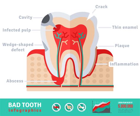 Tooth Abscess Symptoms Causes And Treatments