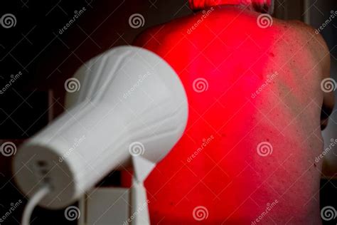 Infrared radiation therapy stock image. Image of medicine - 141152307