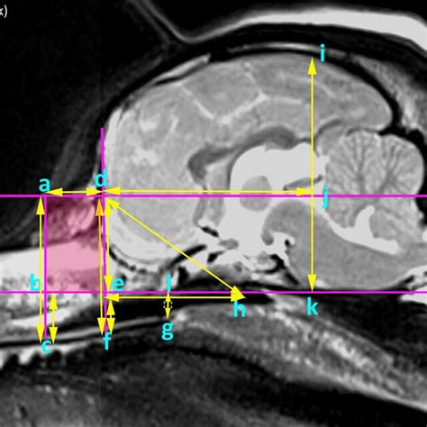 T2 Weighted Midsagittal Magnetic Resonance Imaging Of A Cavalier King