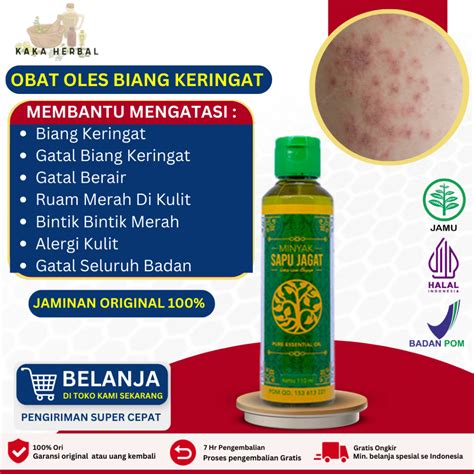 Jual Kaka Herbal Obat Biang Keringat Anak Dan Dewasa Obat Gatal