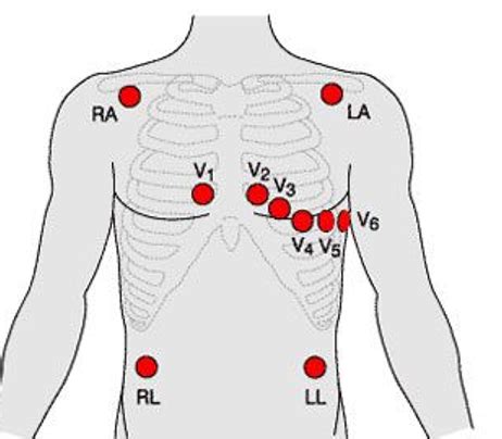 Ekg Module Flashcards Quizlet