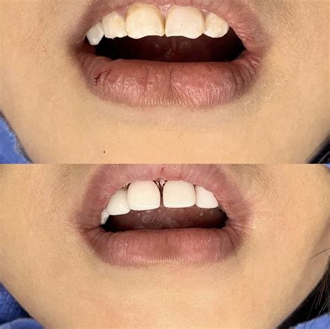 Smile Transformations Pediatric Dentist In Kailua Kona