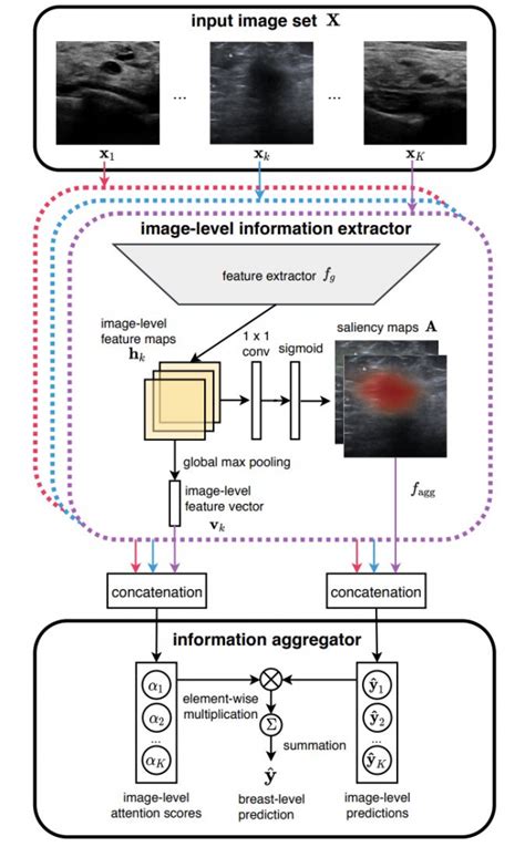 Improving Breast Cancer Detection In Ultrasound Imaging Using AI