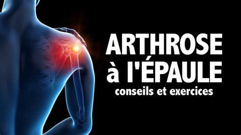 Arthrose à l épaule conseils et exercices YouTube