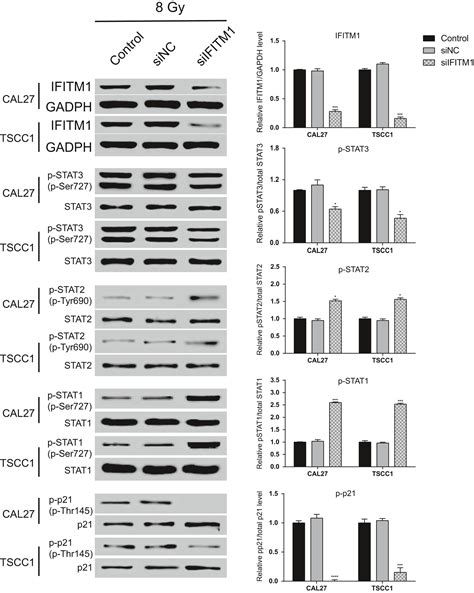 Combination Of Ifitm1 Knockdown And Radiotherapy Inhibits The Growth Of Oral Cancer Yang