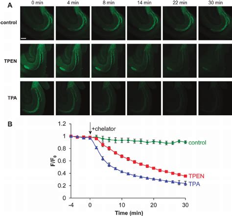 (A) Selected images of acute hippocampal slices recorded with ... 