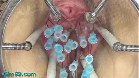 Extreme German BDSM Needles Inner Pussy Cervix And Tits Phim Sex 2024