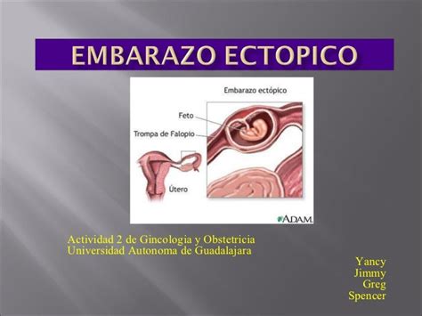 Embarazo Ectopico