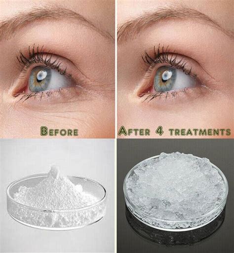 Гиалуронат натрия (sodium hyaluronate) в косметике для лица. Что это ...
