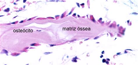 Tecido Sseo Histologia