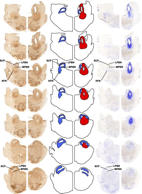 Histochemical And Immunohistochemical Staining For Nissl Substance And