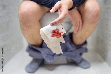 Man Has Stomach Trouble Sitting On Toilet Bowl And Has Diarrhea Or