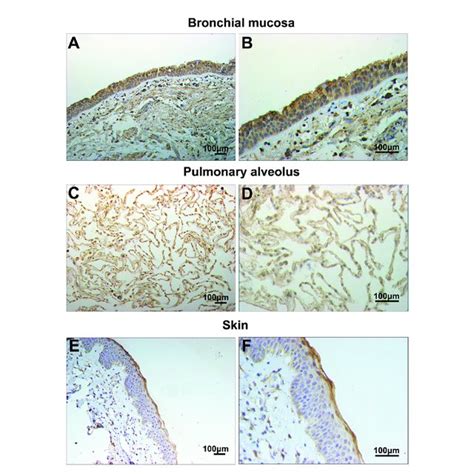 Filaggrin Was Expressed In Normal Human Bronchial Epithelial Cells