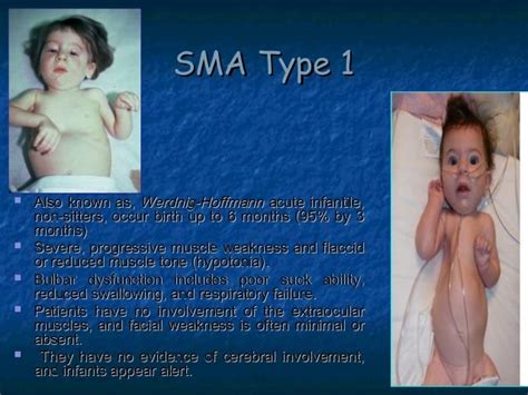 sma type  definition types  diagnostic  traitements ehua