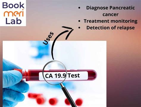 CA 19 9 Test Price Purpose Range And Results 2024 Bookmerilab