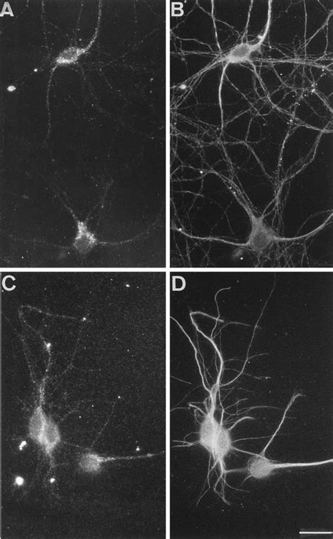 TI VAMP VAM P7 Enriches In Dendrites In Mature Hippocampal Neuron Rat