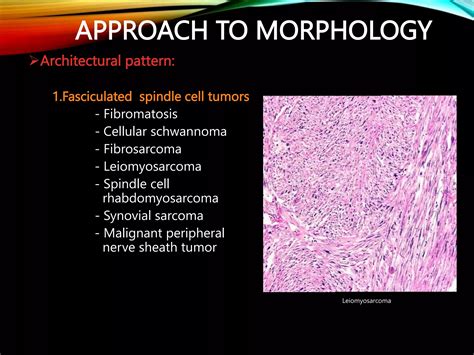 approach  diagonosis  soft tissue sarcomapptx