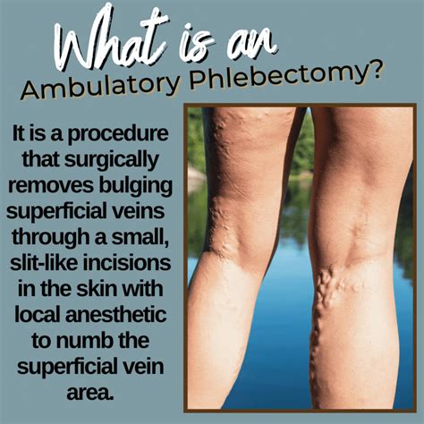 Ambulatory Phlebectomy Ap Edmonton Vein Clinic