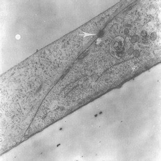 Transmission Electron Micrograph Showing A Tight Junction Between