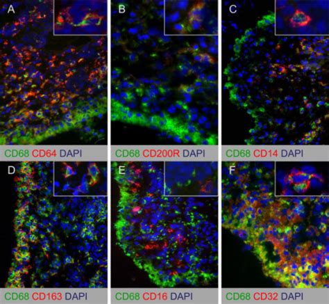 Double Immunofluorescence Stainings Of Cd68 And Macroph Open I