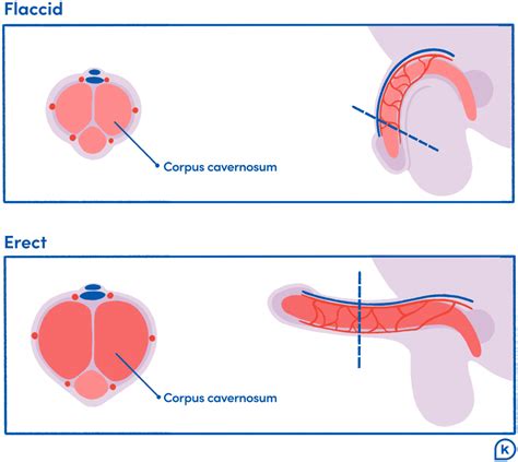 How To Achieve Erection Signexercise2