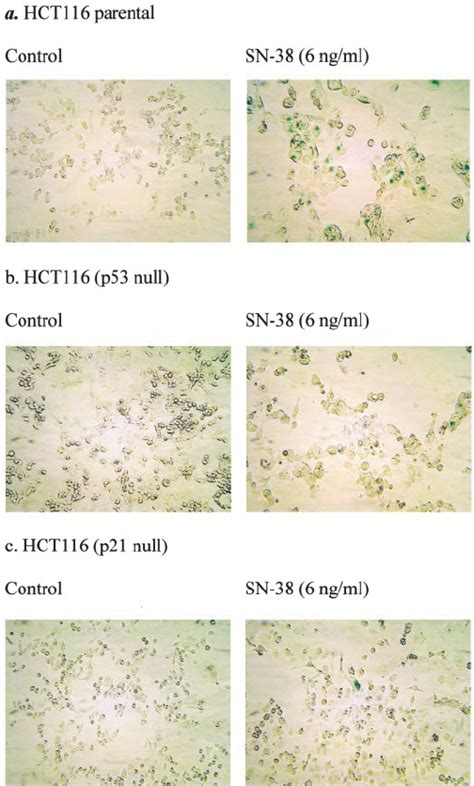 p53 and p21 are required for DNA damage-induced senescence. The HCT116 ... 