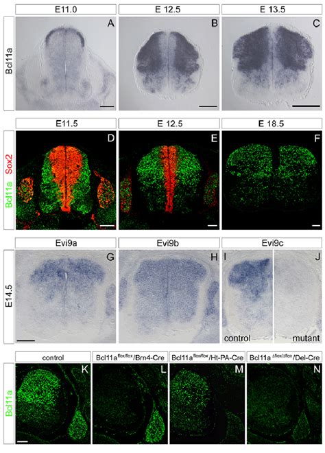 Expression Analysis And Conditional Mutation Of Bcl11a In The Spinal